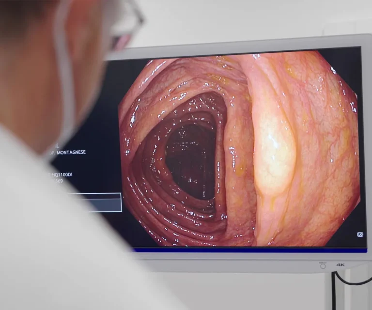 1 Endoscopia - Casa di Cura Villa Mafalda di Roma