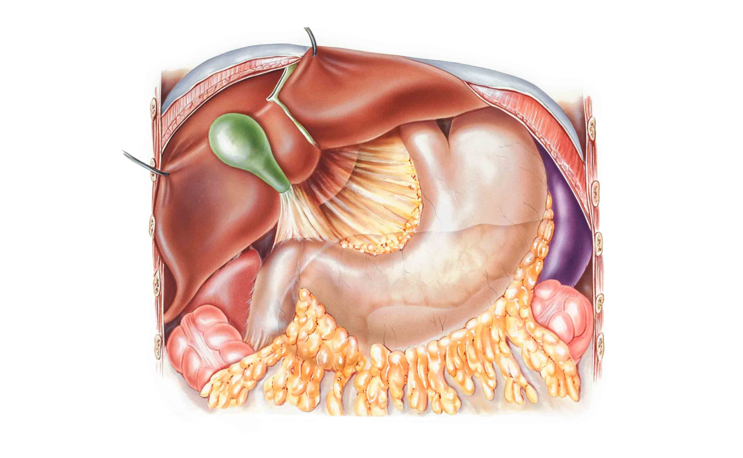 cistifellea